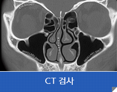 CT 검사