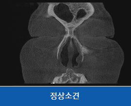비정상소견