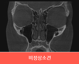 비정상소견
