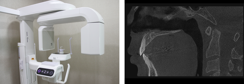 3D-CT 검사