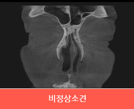 비정상소견