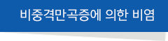 비중격만곡증에 의한 비염